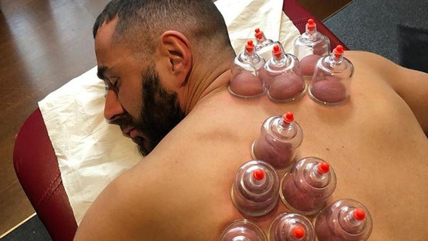 Cupping Therapy